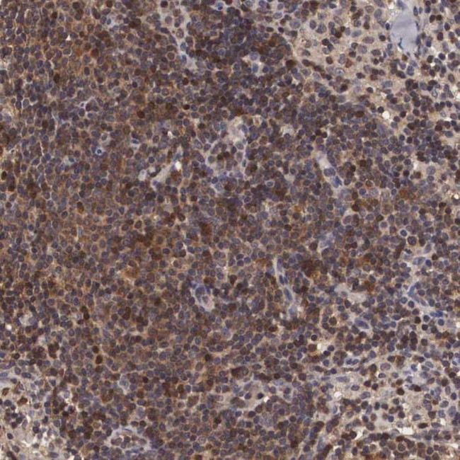 ADSL Antibody in Immunohistochemistry (IHC)