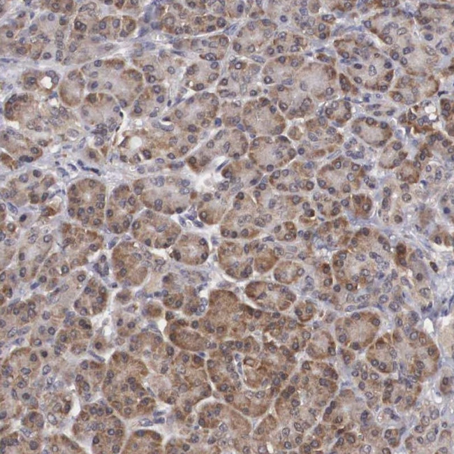 ADSL Antibody in Immunohistochemistry (IHC)