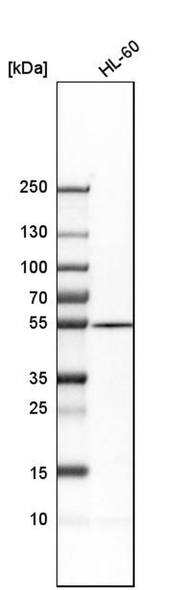 ADSL Antibody in Western Blot (WB)