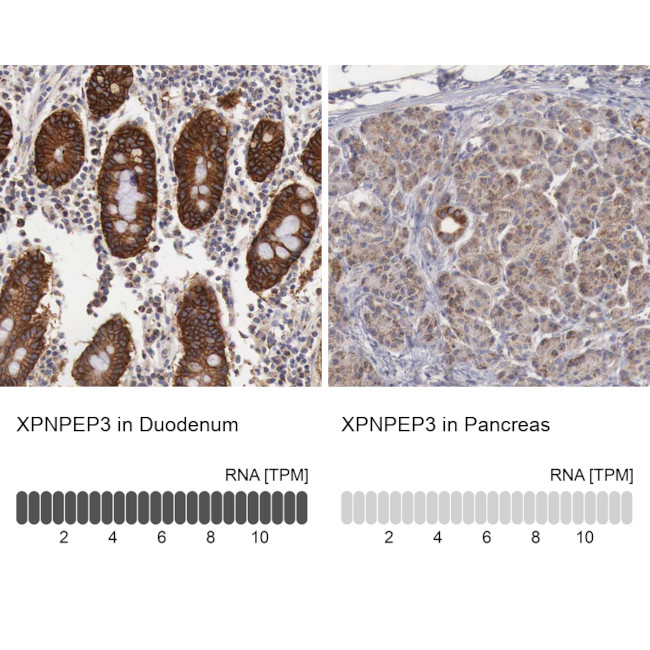 XPNPEP3 Antibody in Immunohistochemistry (IHC)