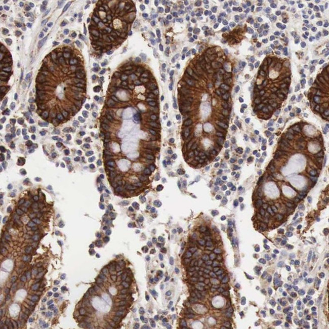 XPNPEP3 Antibody in Immunohistochemistry (IHC)