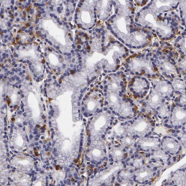 LGALS3BP Antibody in Immunohistochemistry (IHC)