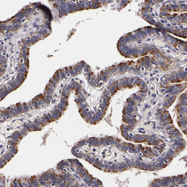 LGALS3BP Antibody in Immunohistochemistry (IHC)