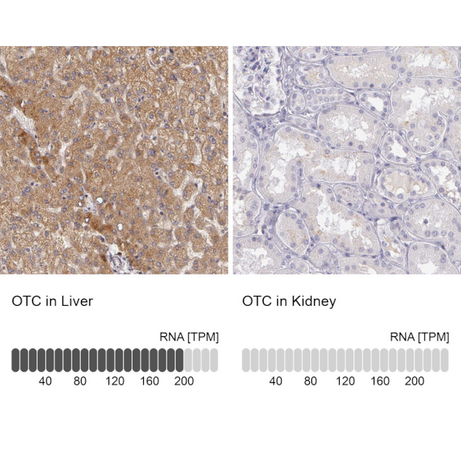 OTC Antibody in Immunohistochemistry (IHC)