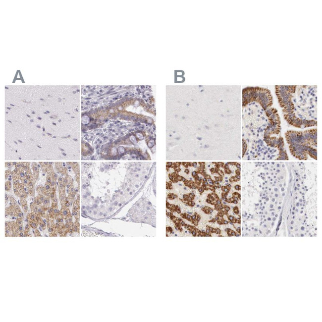 OTC Antibody in Immunohistochemistry (IHC)