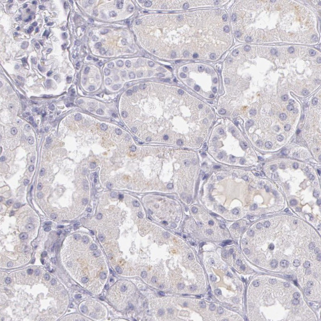 OTC Antibody in Immunohistochemistry (IHC)