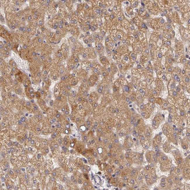 OTC Antibody in Immunohistochemistry (IHC)