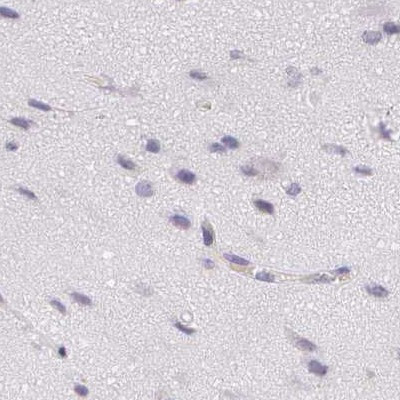 OTC Antibody in Immunohistochemistry (IHC)