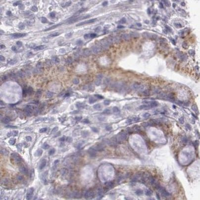 OTC Antibody in Immunohistochemistry (IHC)