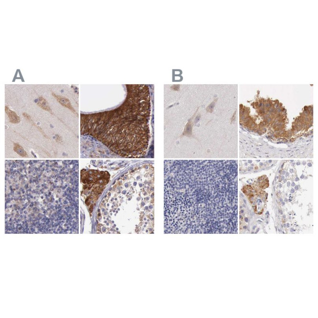 NSDHL Antibody in Immunohistochemistry (IHC)