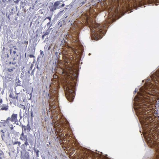 NSDHL Antibody in Immunohistochemistry (IHC)