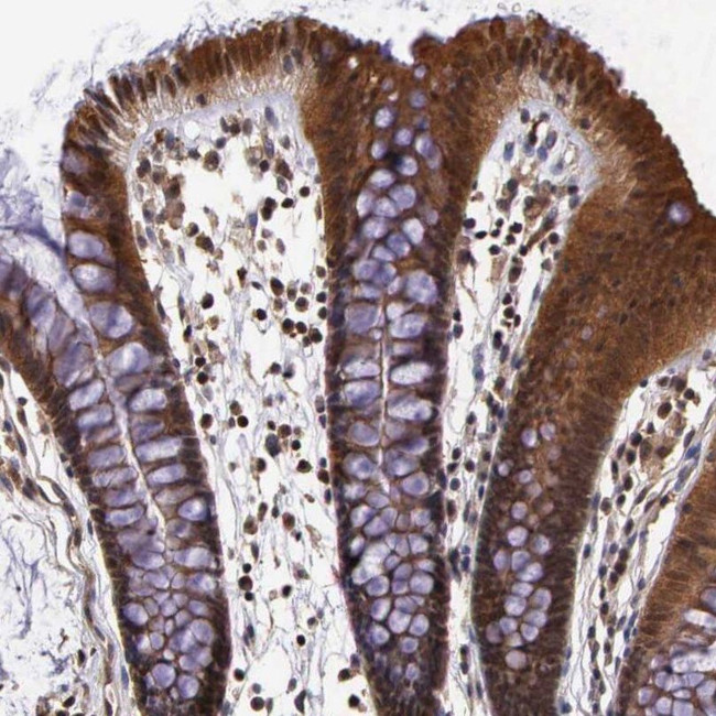 IGBP1 Antibody in Immunohistochemistry (IHC)