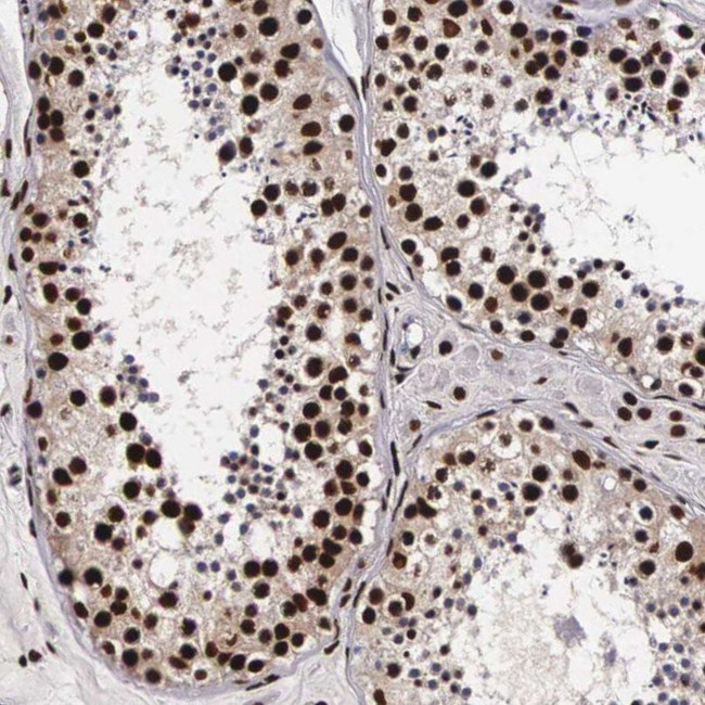 Bcl-W Antibody in Immunohistochemistry (IHC)