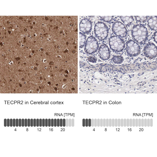 TECPR2 Antibody in Immunohistochemistry (IHC)