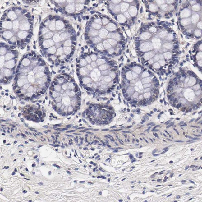 TECPR2 Antibody in Immunohistochemistry (IHC)