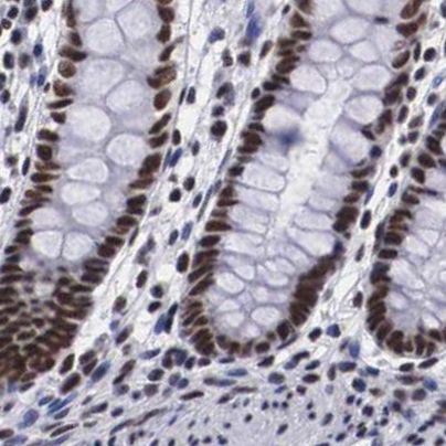 SF3A1 Antibody in Immunohistochemistry (IHC)