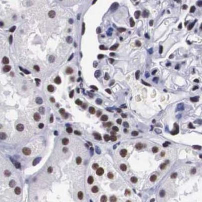 SF3A1 Antibody in Immunohistochemistry (IHC)