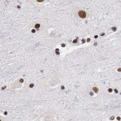 SF3A1 Antibody in Immunohistochemistry (IHC)