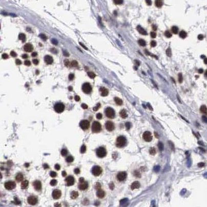 SF3A1 Antibody in Immunohistochemistry (IHC)