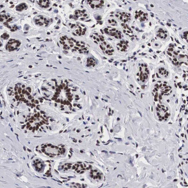 SF3A1 Antibody in Immunohistochemistry (IHC)