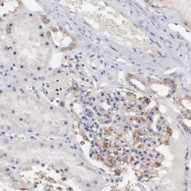 INF2 Antibody in Immunohistochemistry (IHC)