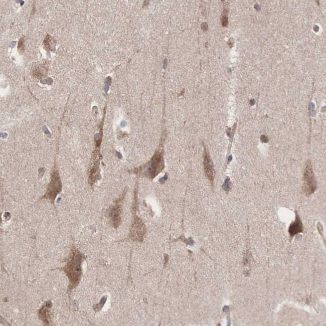 INF2 Antibody in Immunohistochemistry (IHC)