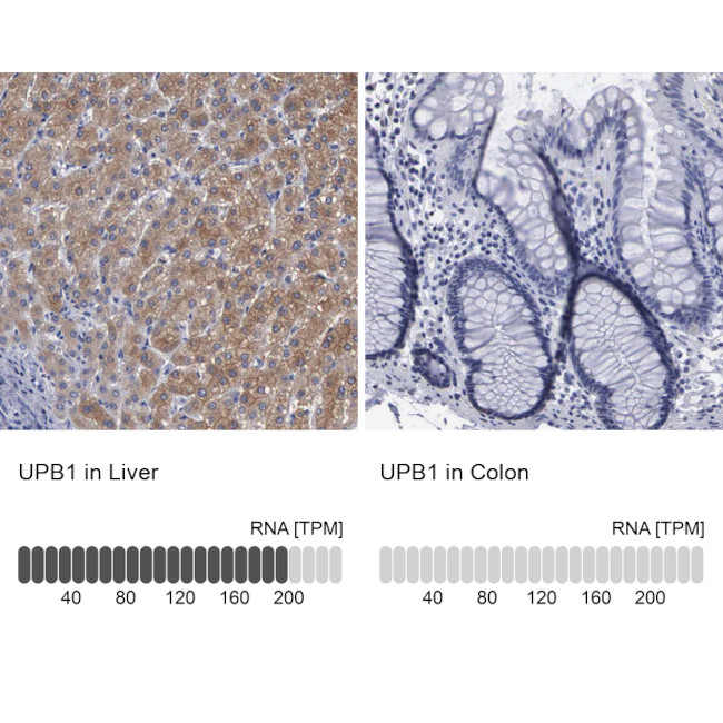 UPB1 Antibody in Immunohistochemistry (IHC)