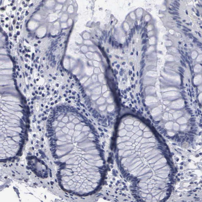 UPB1 Antibody in Immunohistochemistry (IHC)