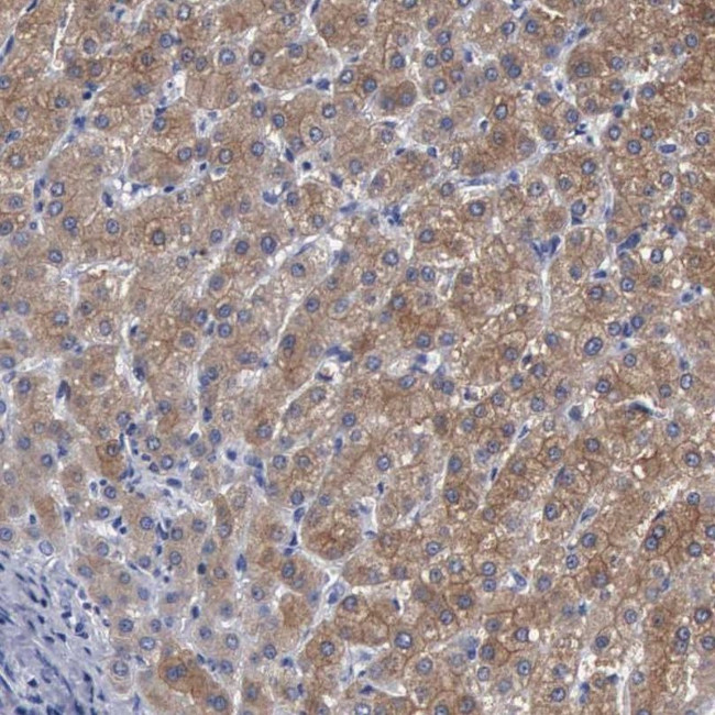 UPB1 Antibody in Immunohistochemistry (IHC)