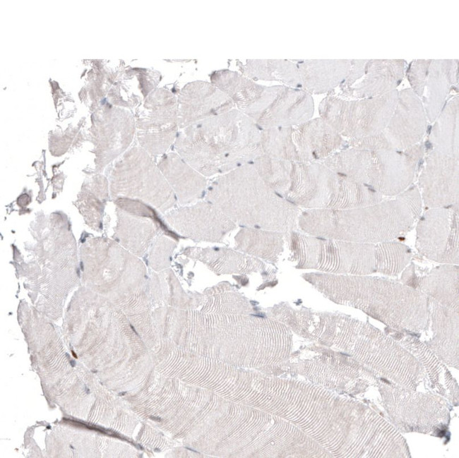 ACOT4 Antibody in Immunohistochemistry (IHC)