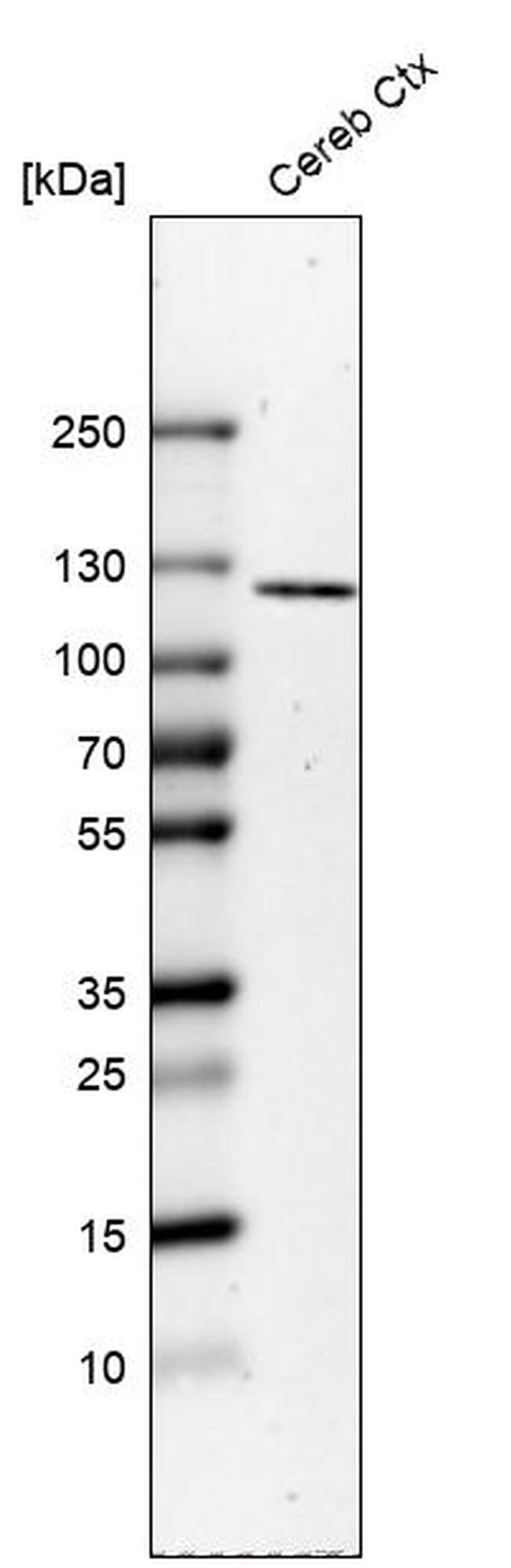 ELFN2 Antibody in Western Blot (WB)