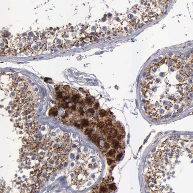 NPC2 Antibody in Immunohistochemistry (IHC)