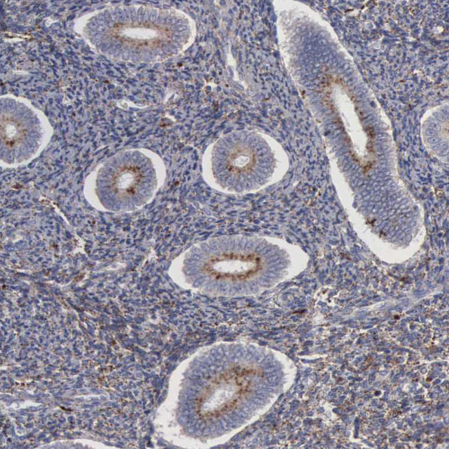 NPC2 Antibody in Immunohistochemistry (IHC)