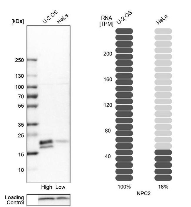 NPC2 Antibody in Western Blot (WB)