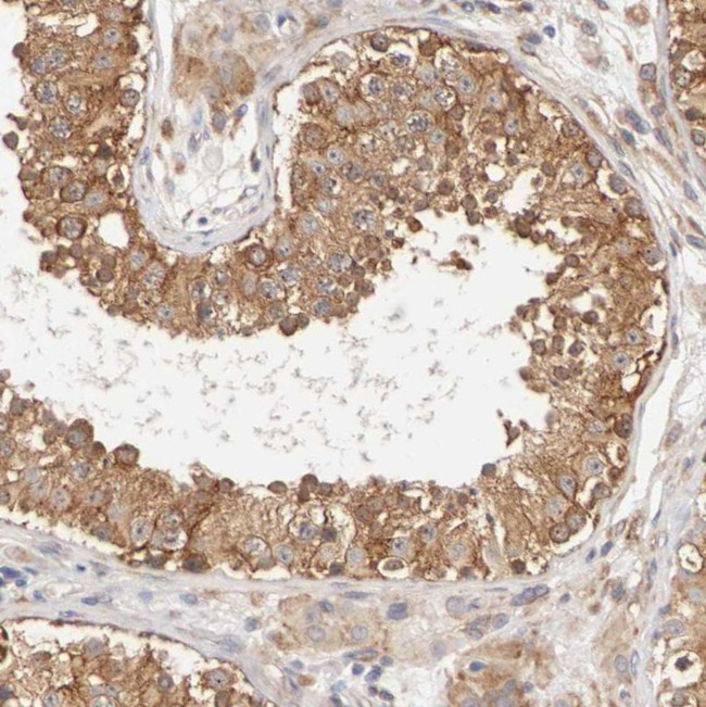 FKBP25 Antibody in Immunohistochemistry (IHC)