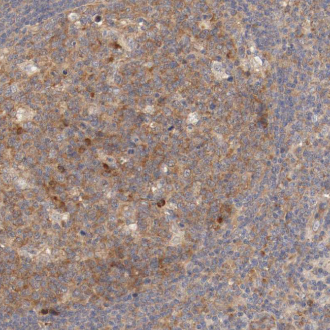 FKBP25 Antibody in Immunohistochemistry (IHC)