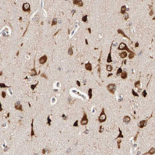 FKBP25 Antibody in Immunohistochemistry (IHC)