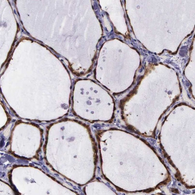 GMPR2 Antibody in Immunohistochemistry (IHC)