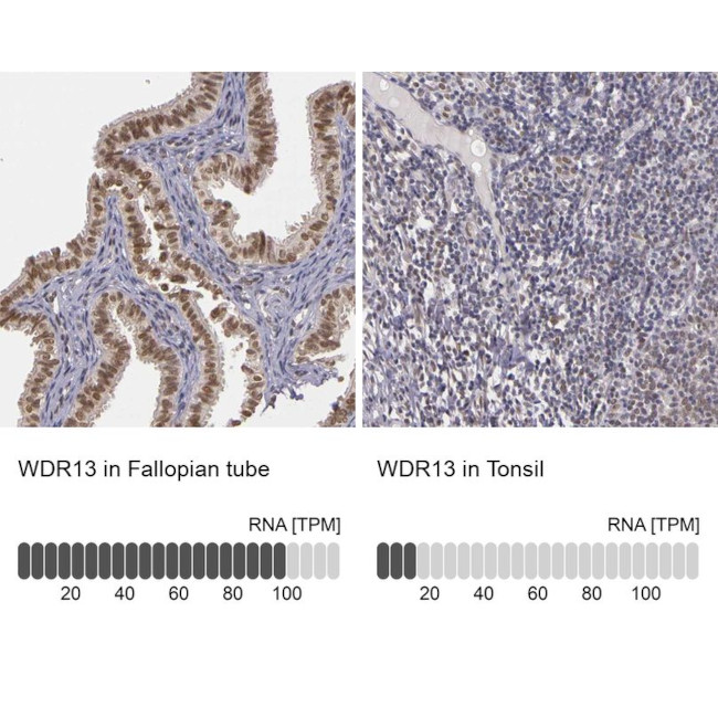 WDR13 Antibody in Immunohistochemistry (IHC)