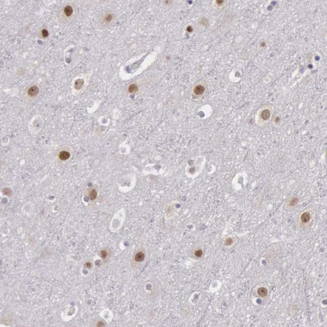 NKAP Antibody in Immunohistochemistry (IHC)