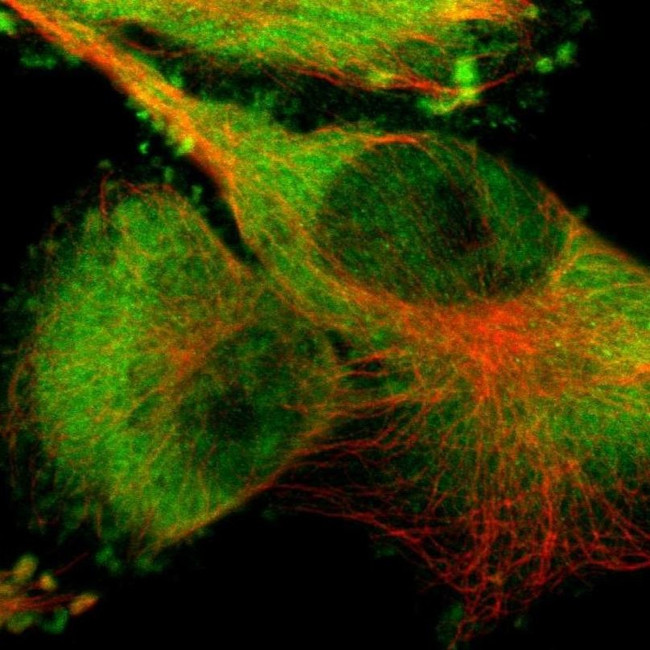 PYGL Antibody in Immunocytochemistry (ICC/IF)