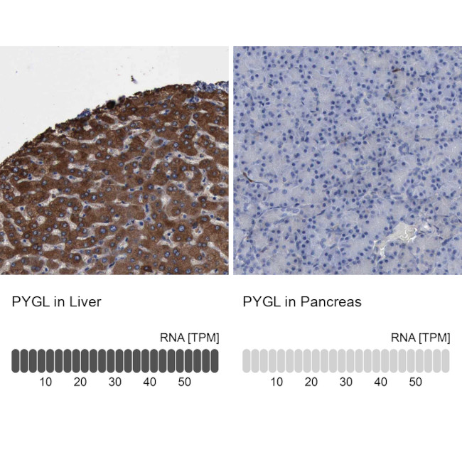 PYGL Antibody in Immunohistochemistry (IHC)