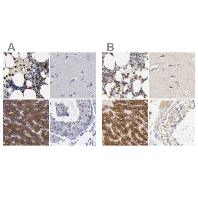 PYGL Antibody in Immunohistochemistry (IHC)