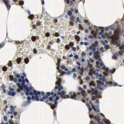 PYGL Antibody in Immunohistochemistry (IHC)