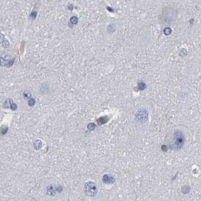 PYGL Antibody in Immunohistochemistry (IHC)