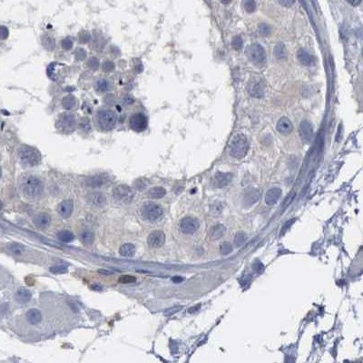 PYGL Antibody in Immunohistochemistry (IHC)