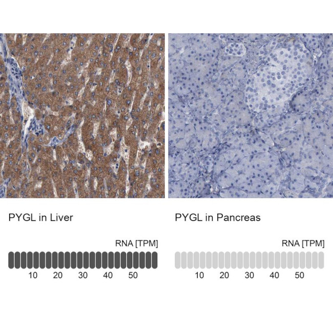 PYGL Antibody