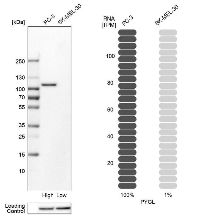 PYGL Antibody in Western Blot (WB)