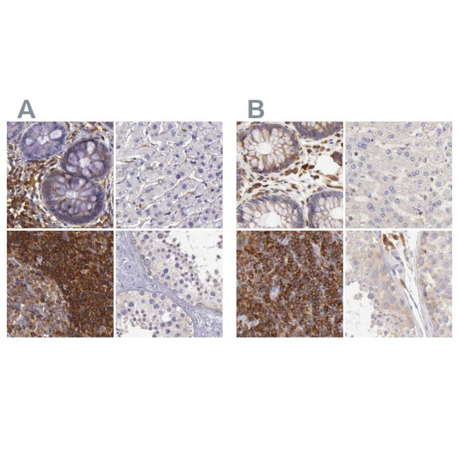 RhoGAP4 Antibody in Immunohistochemistry (IHC)