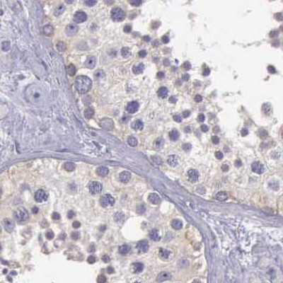 RhoGAP4 Antibody in Immunohistochemistry (IHC)